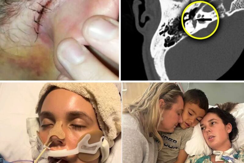 Woman hears Strange noises since Birth, 37 years later she discovers the Strange Reason