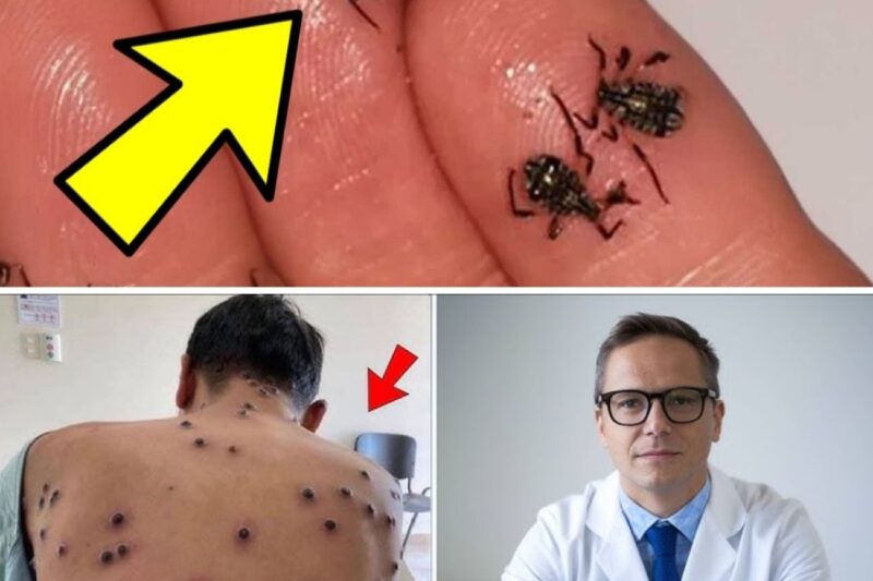 Man Thought He Had ‘Bedbugs’, Expert Turns Pale After Realizing What They Actually Are