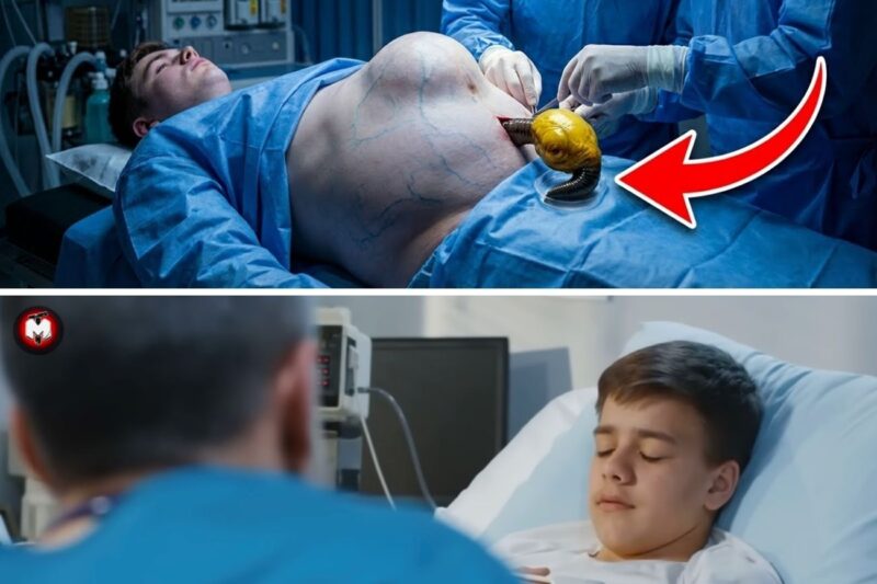 Mom Ignores Son’s Swollen Belly — Until Doctors Open It and Freeze in Horror!
