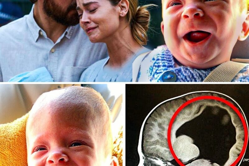 Boy Born Without A Brain, 6 Years Later Look At What Doctors Find Inside
