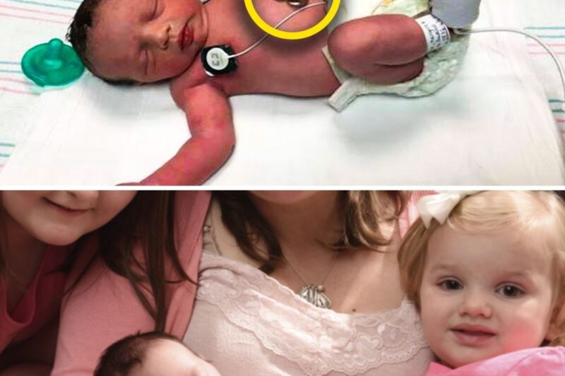 A Baby Was Taken From The Womb To Have A Tumor Removed – Then Returned To Be Born 12 Weeks Later