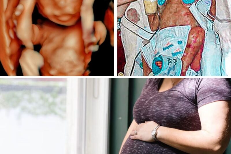 She Learned That Her Baby Would Die But Chose To Treasure The Pregnancy