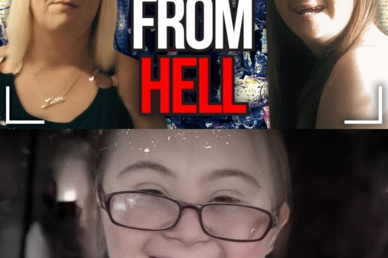 Mom Lets Disabled Daughter Get Devoured By Scabies
