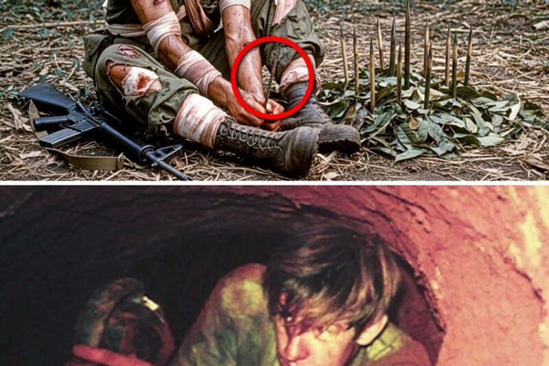 Vietnam’s worst INJURIES for US Soldiers