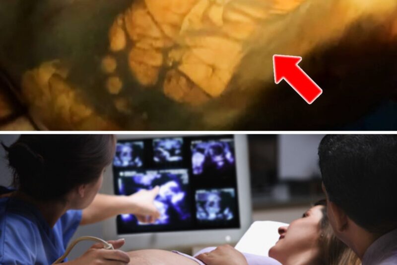 A 41-Week Pregnant Woman Came to the Hospital. What the Doctors Discovered Shocked Everyone!