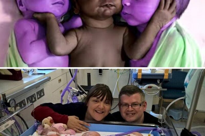 Triplets Dies At Birth And They Cling To Each Other. Then, The Unthinkable Happens!