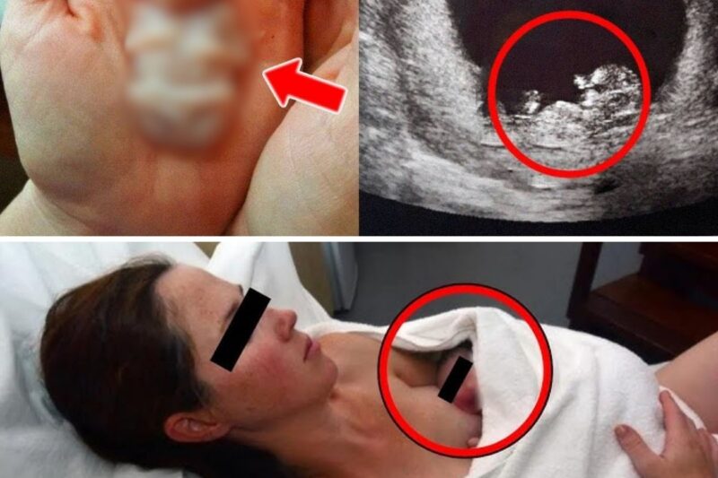6 Weeks After Giving Birth Mom Came Back Because She Felt ‘Weird’, Doctor Turns Pale When He Saw…