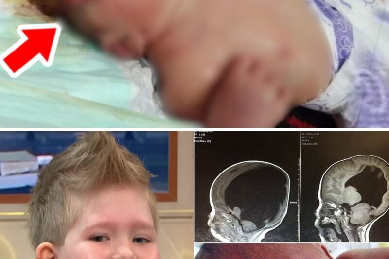 Doctors Said He Had No Brain at Birth—6 Years Later, They Looked Again and Were Speechless！