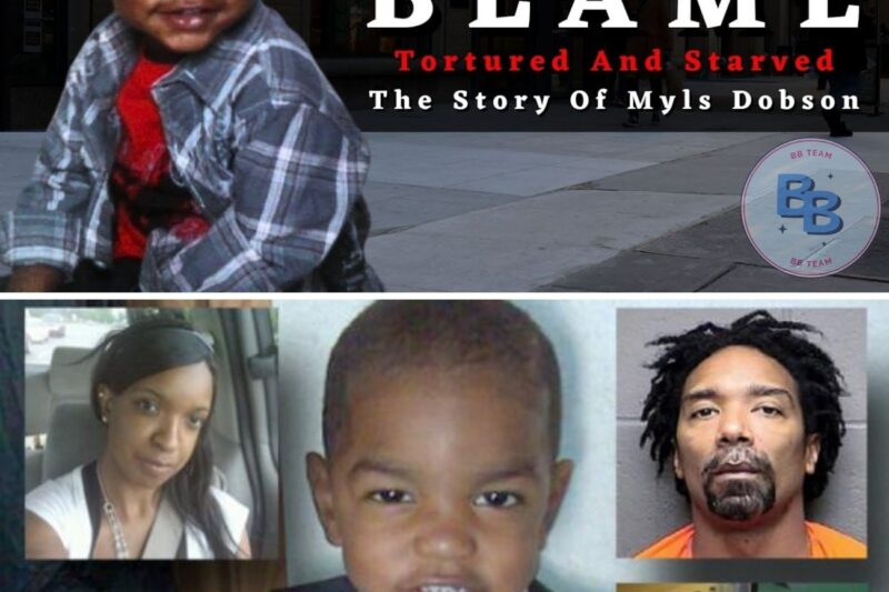 Unimaginable Cruelty. Cigarettes Put Out On His Face, Not Fed For Weeks – The Story Of Myls Dobson