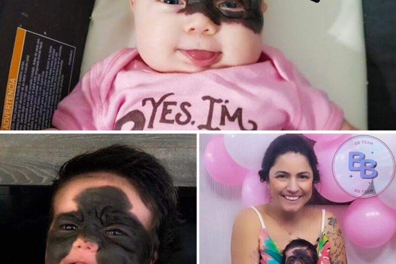 She Was Born With A Big Black Mark On Her Face! Her Parents’ Reaction When They Saw Her Is Shocking!