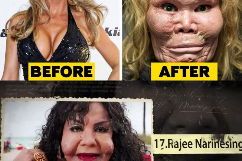 20 Celebrity Plastic Surgery Disasters