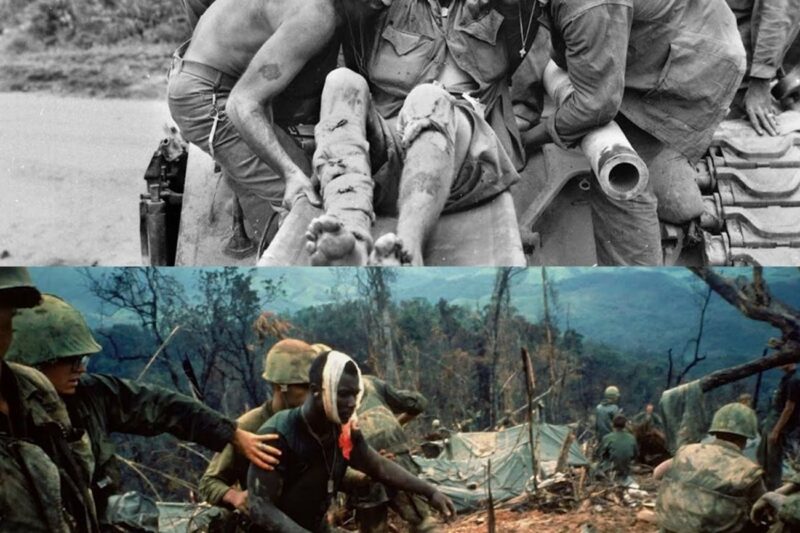 Vietnam’s most GRUESOME Infections faced by US Soldiers!