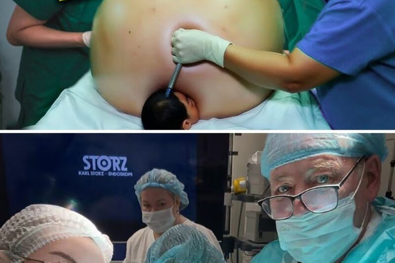 She Walked Into the ER With a Giant Belly—What Was Inside Left Everyone Speechless!
