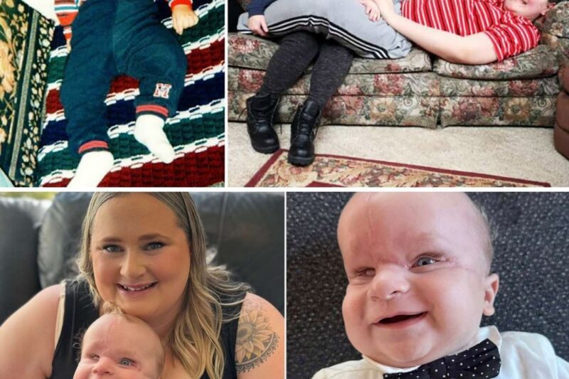 Baby Growing So Rapidly That His Mom Can’t Care For Him Soon Gets The Strangest Diagnosis