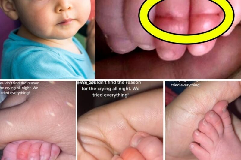 When A Mom Spotted A Strange Mark On Her Baby’s Toes, She Knew She Had To Warn Other Parents