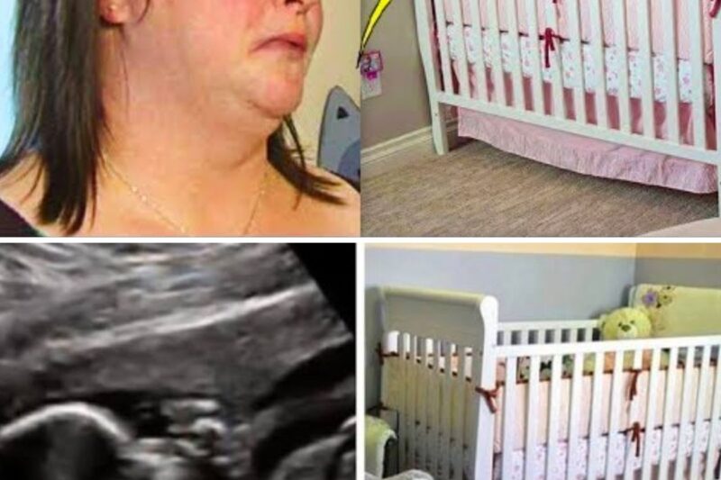 A Baby Boy Was Born With An Abnormally Long Head. Then The Doctor Gave His Family Terrifying News