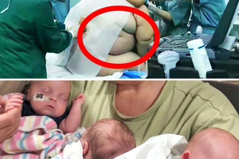 Doctor Is Shocked By What He Saw When A Mother Gave Birth To Triplets