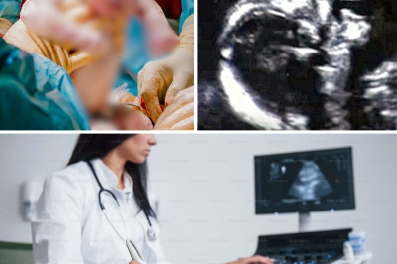 Woman Spent Thousands of Dollars to Get Pregnant: When Doctors Saw the Ultrasound, They Were Shocked