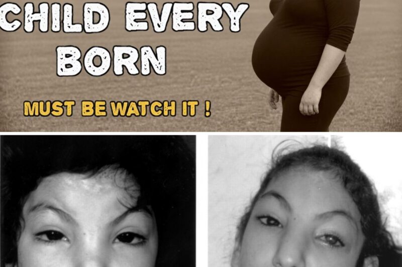 The Most Inbred Child Ever Born | A True Medical Horror Story