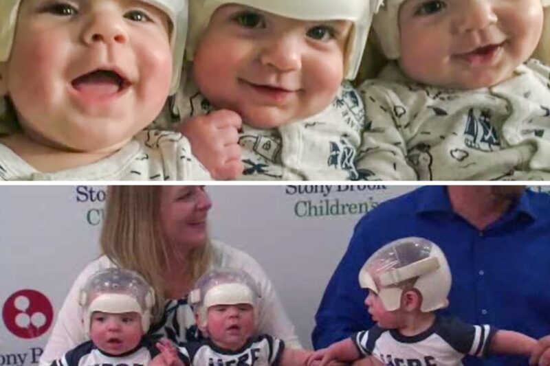 When This Woman Gave Birth To Triplets, Doctors Realized That Something Was Wrong With Their Heads