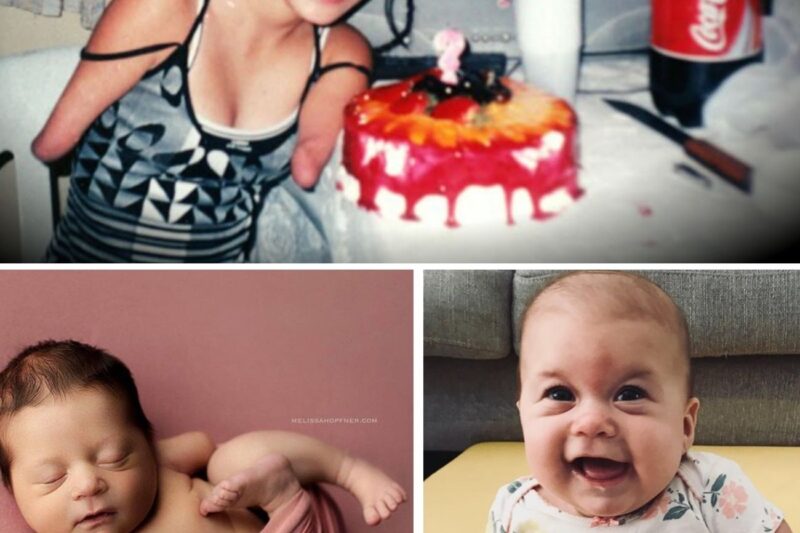 Doctor Said Girl Born Without Arms Wouldn’t Amount To Anything. 20 Years Later He Turns Pale