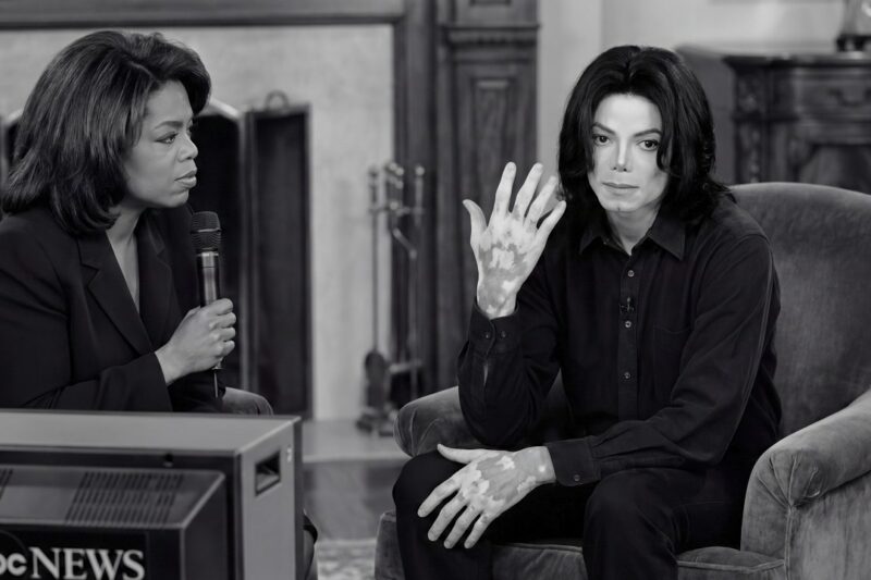 Michael Jackson Showed Oprah His Vitiligo in Live Interview —90M Viewers Were Glued to Their Screens